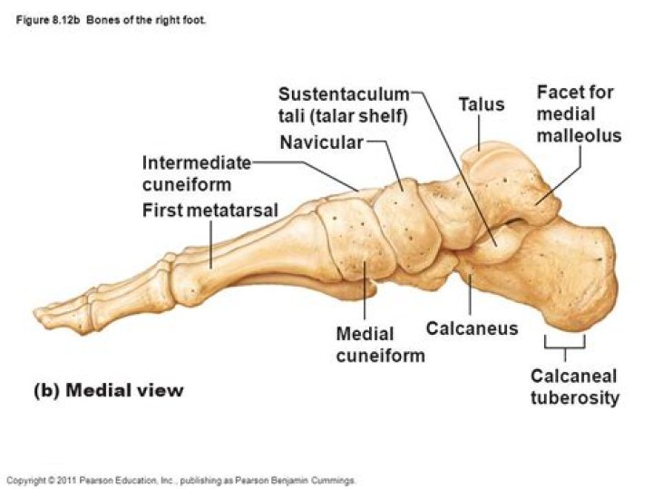 calcaneus tuberosity