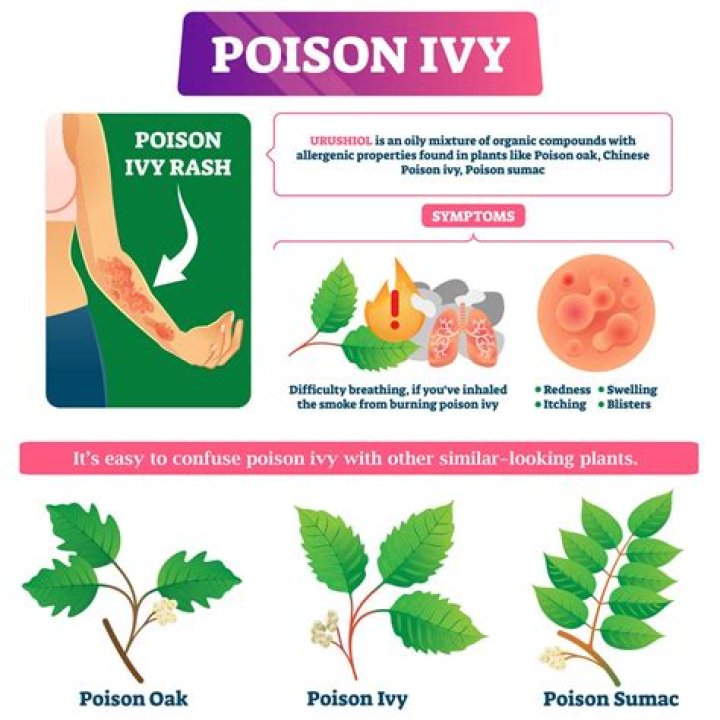 can poison ivy spread from person to person