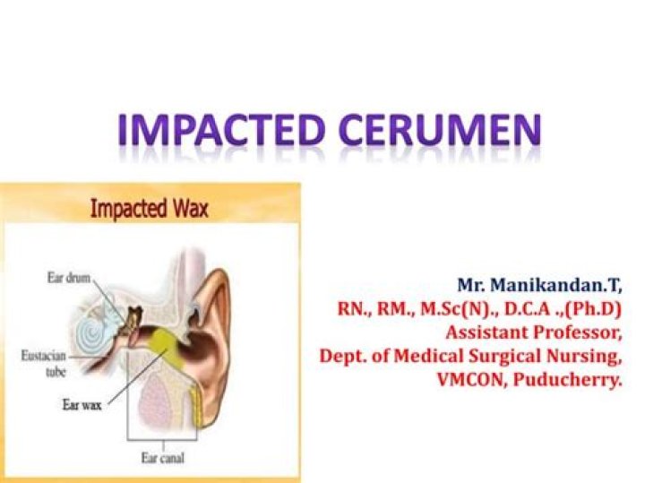 cerumen impaction icd 10