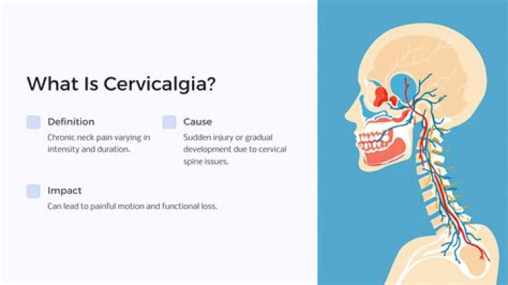 cervicalgia meaning