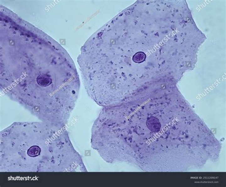 cheek cells