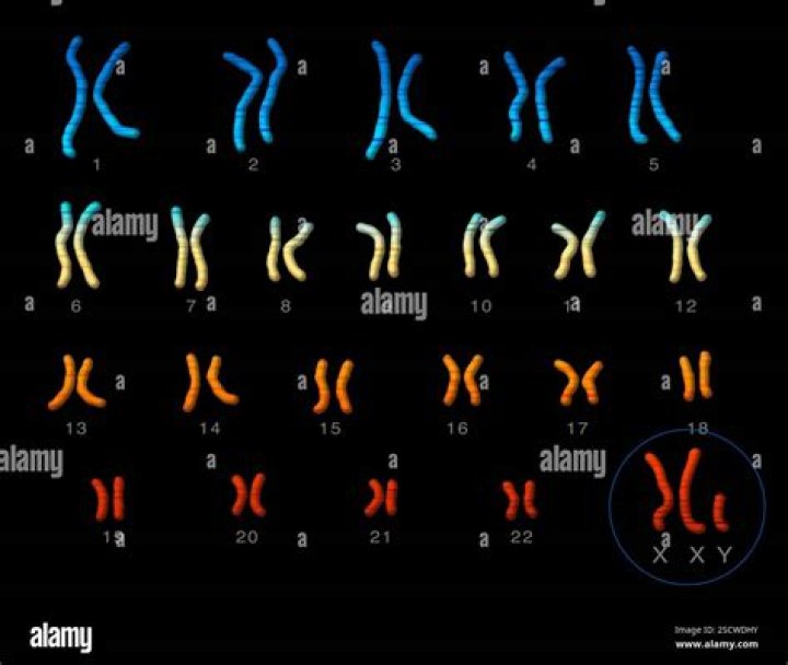 chromosomes are present in