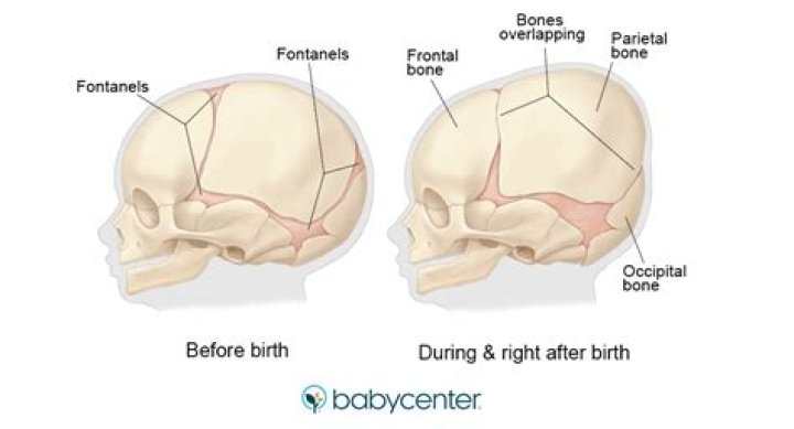 how many bones are babies born with