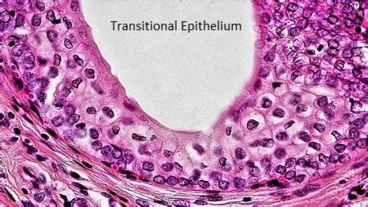 transitional epithelium is found in