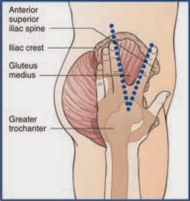 ventrogluteal injection site